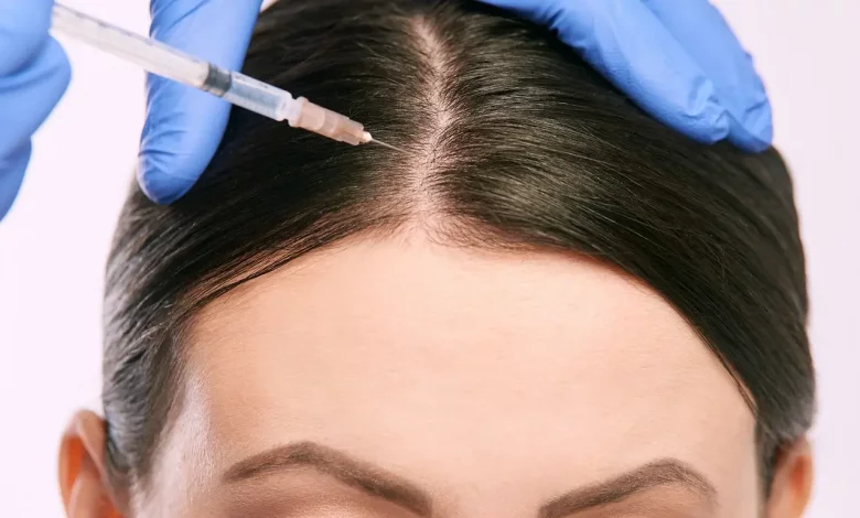 Pursuing a Baldness Cure: The Best Path to Hair Restoration - Vera Clinic