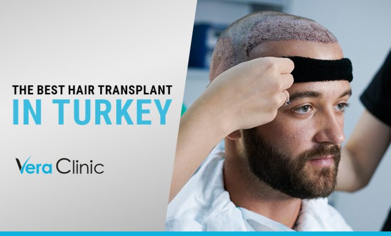 Best Hair Transplant In Turkey Vera Clinic