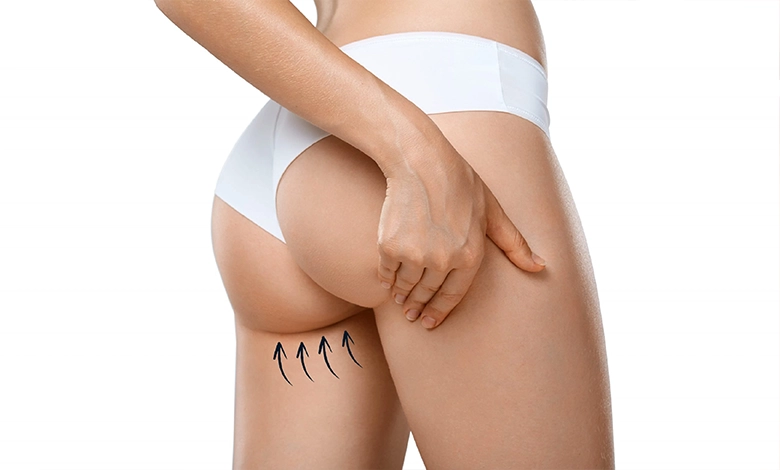 Brazilian Butt Lift  Cosmetic Surgery Turkey - Vera Clinic