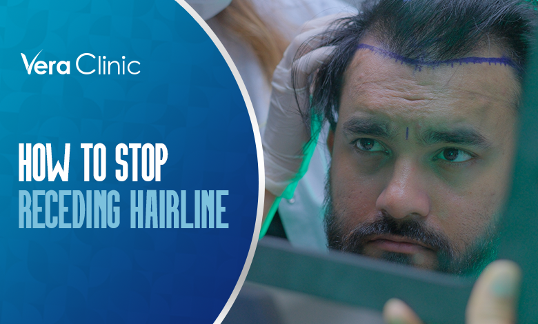 7 Ways To Tell Your Hairline Is Receding And The Best Treatments - Wimpole  Clinic