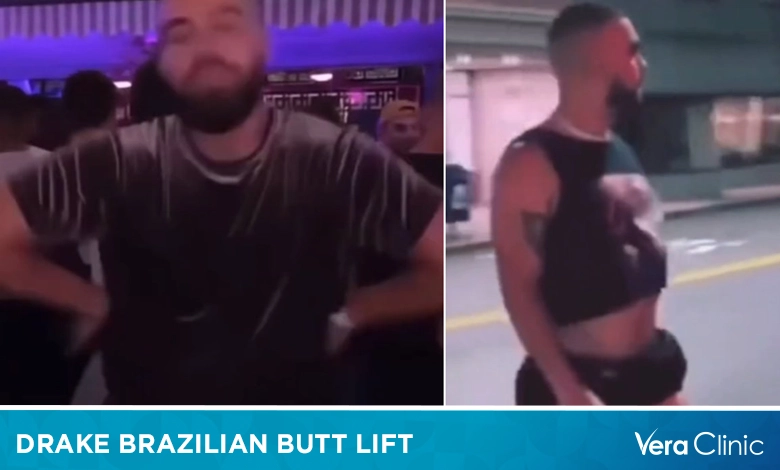 Brazilian Butt Lift Drake: Is it real or fake?