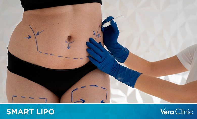 Smart Lipo Cost: Exploring the Factors That Determine Pricing