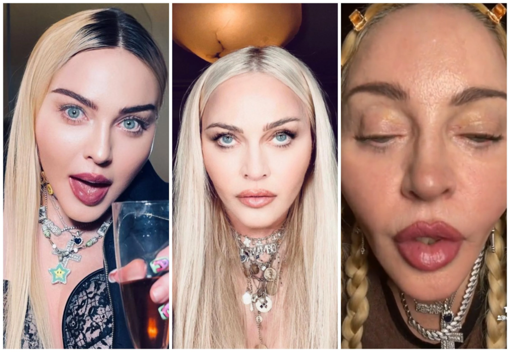 Madonna Plastic Surgery Before And After Through The Years