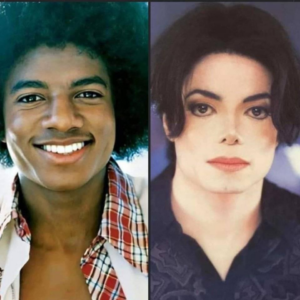 Michael Jackson Plastic Surgery: Exploring The Transformations