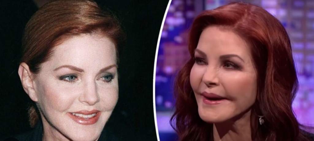 Priscilla Presley Plastic Surgery: An Icon Through Her Life