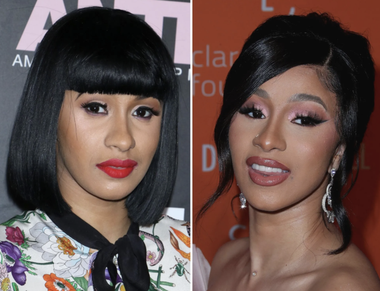 Cardi B Nose Job: A New Look Alongside Musical Journey