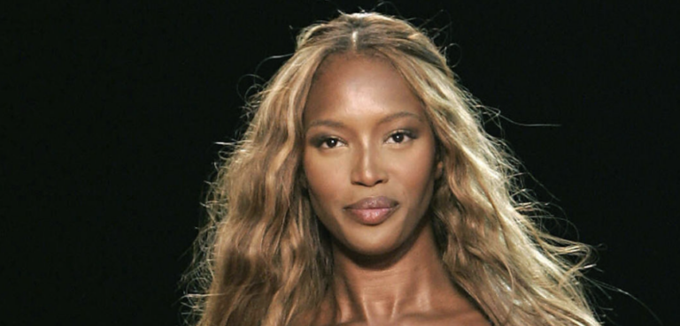 Naomi Campbell Hair Loss: From Bald Spots to Natural Hair