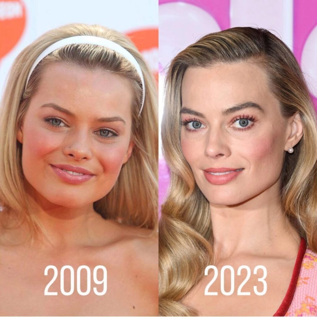 Margot Robbie Plastic Surgery: Unveiling the Transformation and Rumors