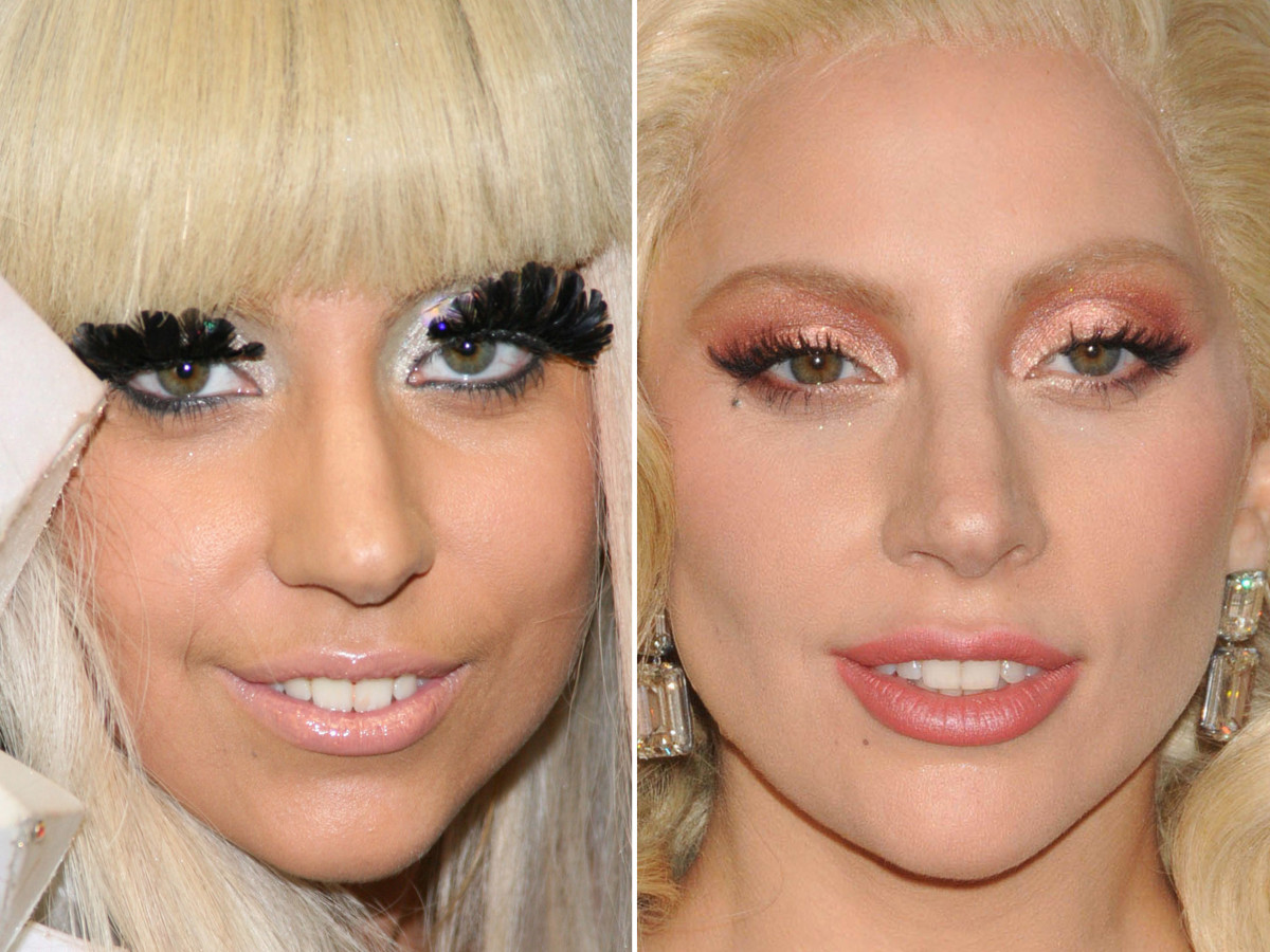 Lady Gaga Plastic Surgery Unveiling The Transformation