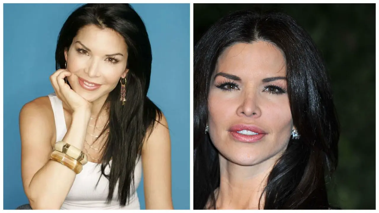 Lauren Sanchez Plastic Surgery: Facts, Rumors, and the Beauty Evolution