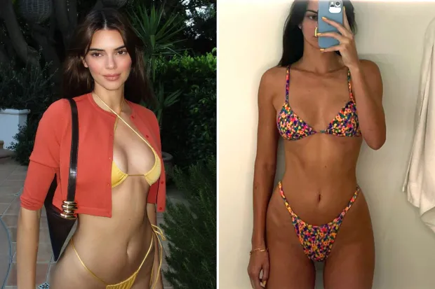 Kendall Jenner Plastic Surgery Journey Exploring the Rumors and