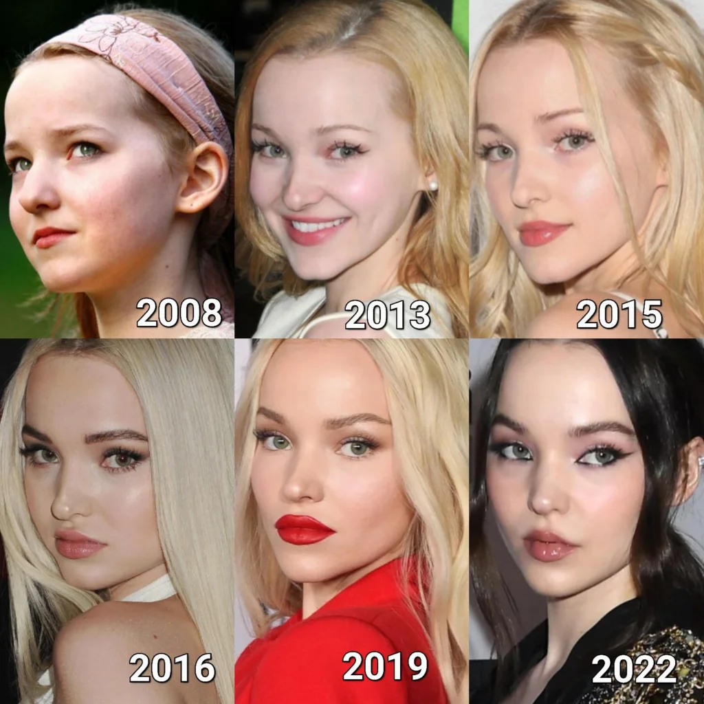 Dove Cameron Before Plastic Surgery