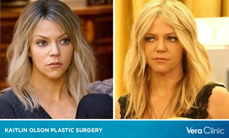 Kaitlin Olson Plastic Surgery From Natural Beauty to Cosmetic