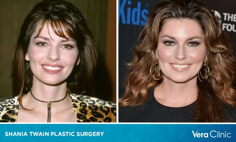 Shania Twain Plastic Surgery A Deep Dive Into Her Evolving Appearance