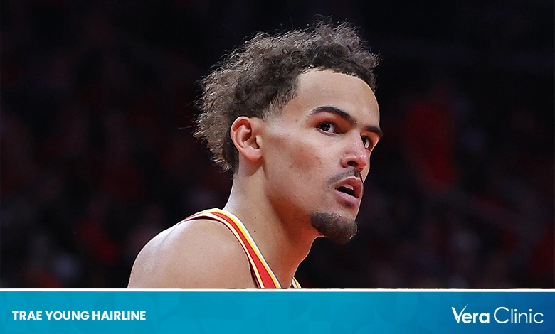 Trae Young Hairline: Unraveling the Mystery